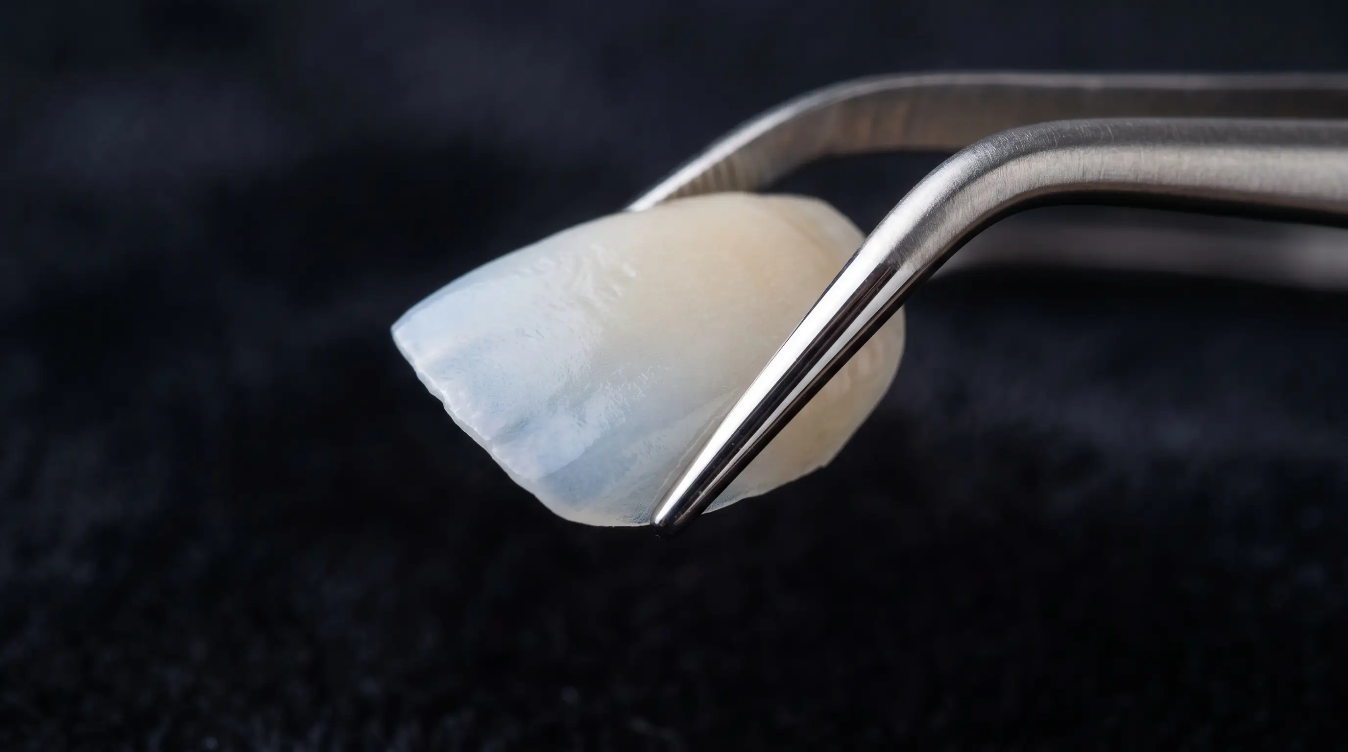 Macro-photographie d'une facette dentaire en céramique, détail de la texture et de la translucidité, Clinique LaBeldent Mohammedia