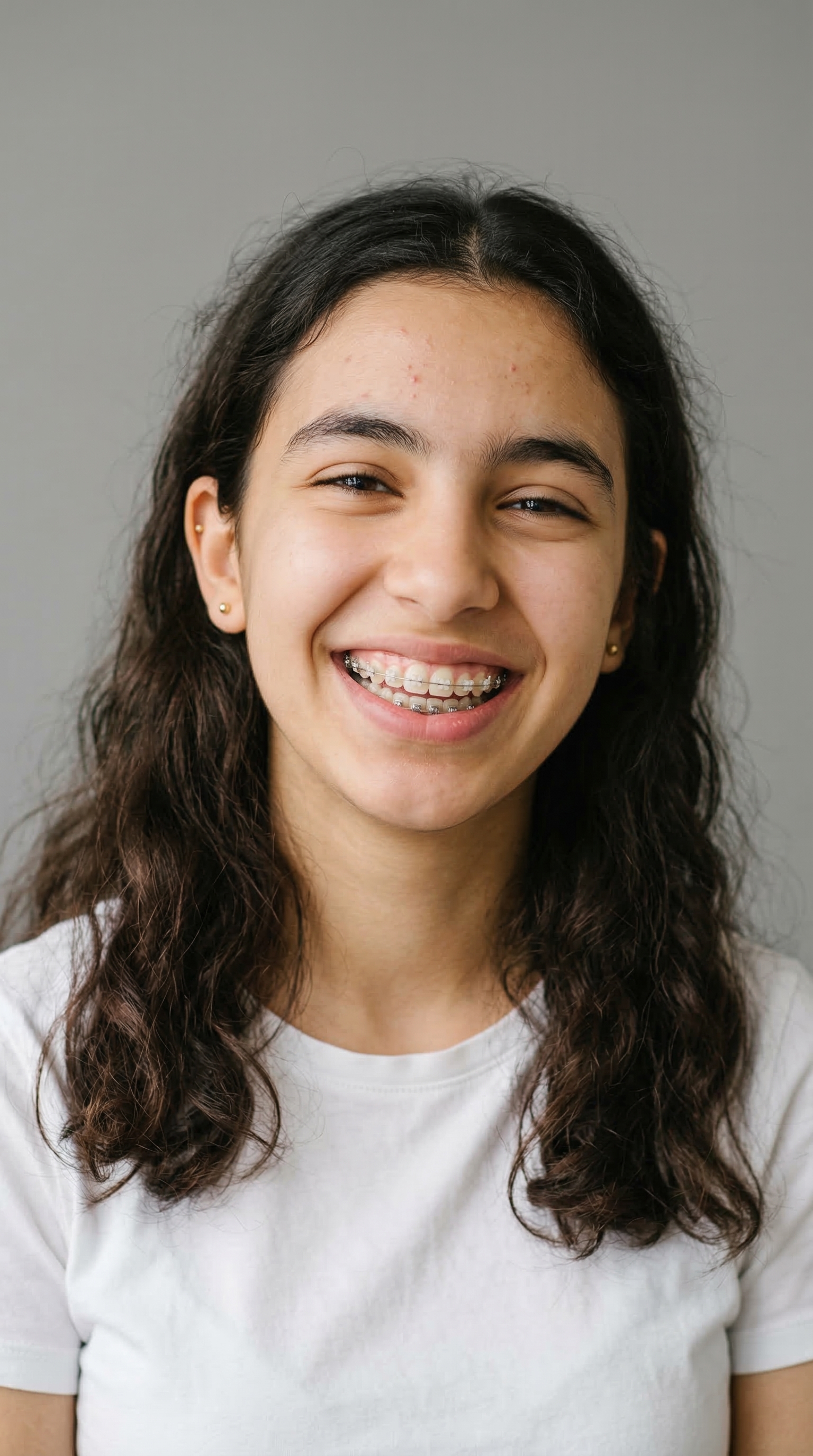 Types de malocclusions corrigées par orthodontie à la Clinique LaBeldent Mohammedia : encombrement, surplomb, béance